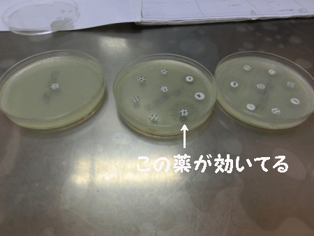 細菌培養検査